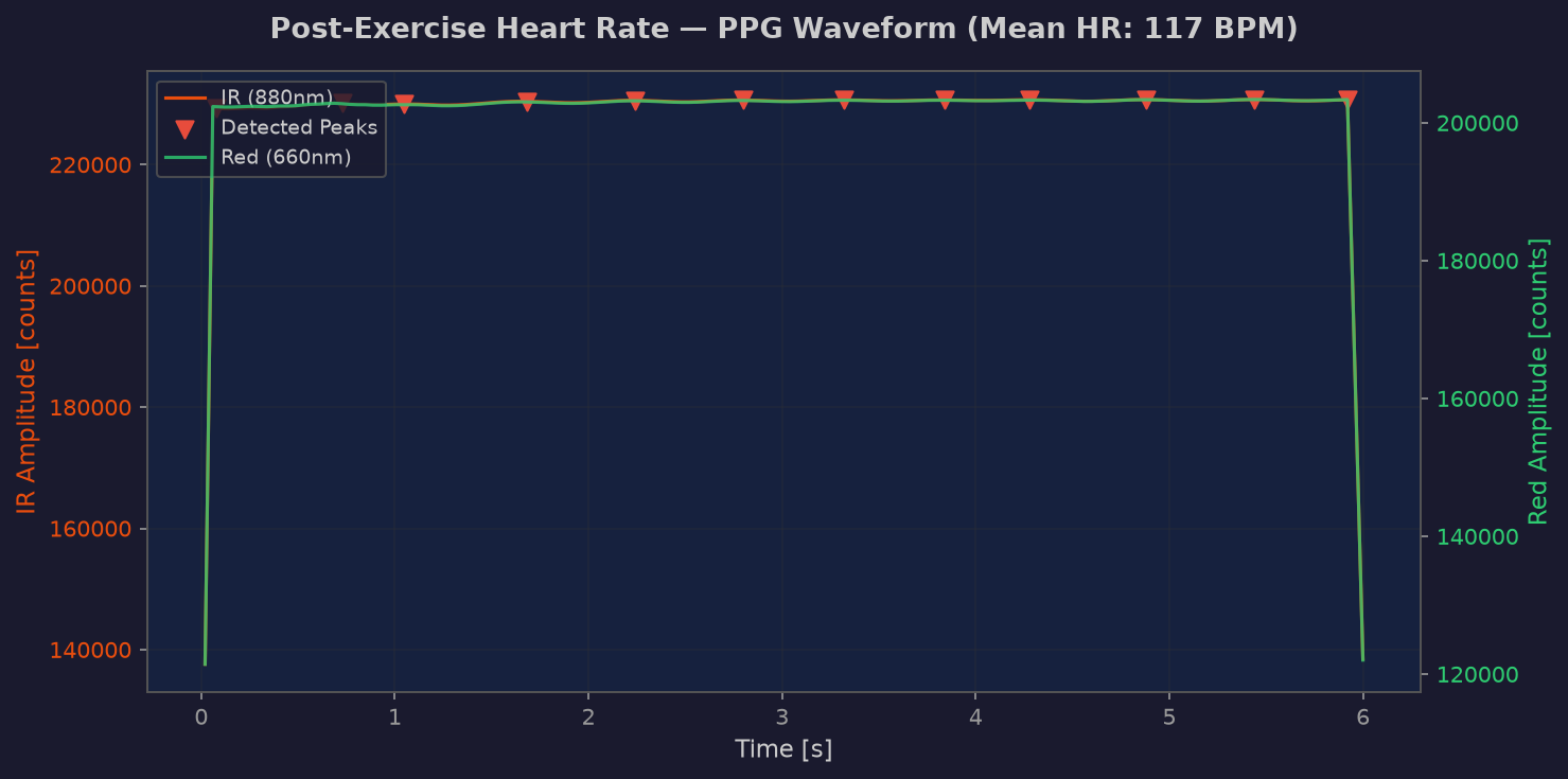 Post-exercise PPG waveform