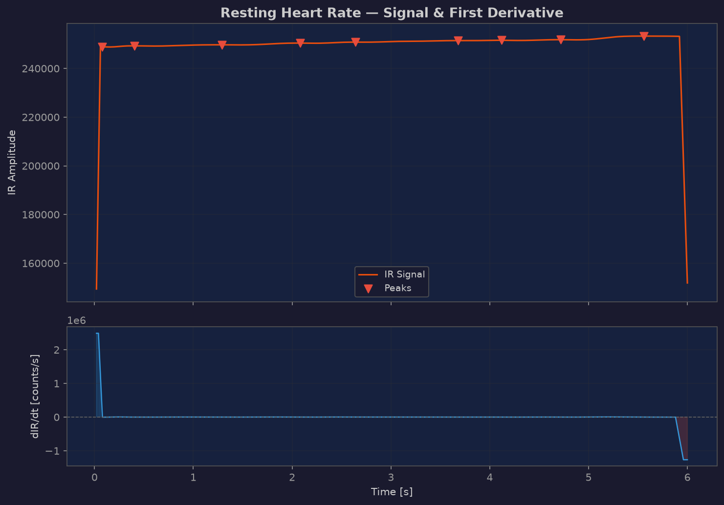 Resting PPG first derivative analysis